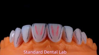 Standard Dental Lab Co., Limited производственная линия производителя