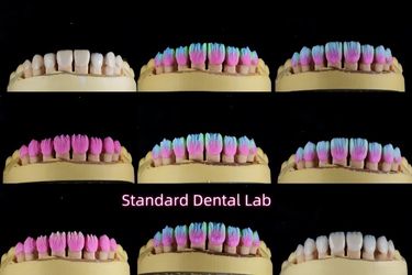 Standard Dental Lab Co., Limited производственная линия производителя