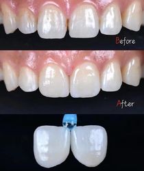 Standard Dental Lab Co., Limited производственная линия производителя