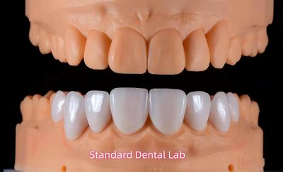 Standard Dental Lab Co., Limited производственная линия производителя