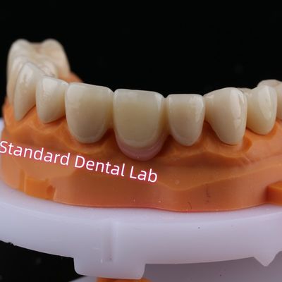 Купить Цифровое CAD CAM фрезерное слойное циркониевое мостовое короны с розовым фарфором онлайн изготовление