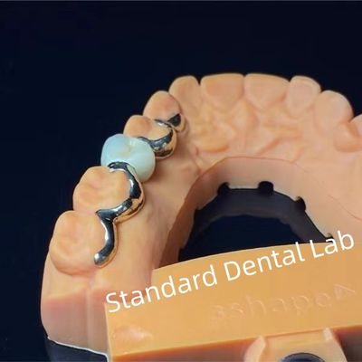 Купить Зубные зубы PFM Maryland Bridge Высокая эстетика Сертификат FDA онлайн изготовление