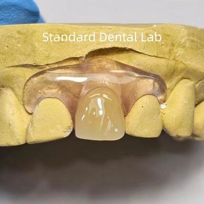 Купить Стоматологический TCS Valplast Гибкие частичные зубные протезы Окрашивание Устойчивые к исчезающим запахам онлайн изготовление