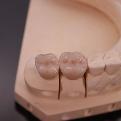 Купить Удобная цирконовая корона с точной эстетической отделкой Экспресс 3-4 дня онлайн изготовление