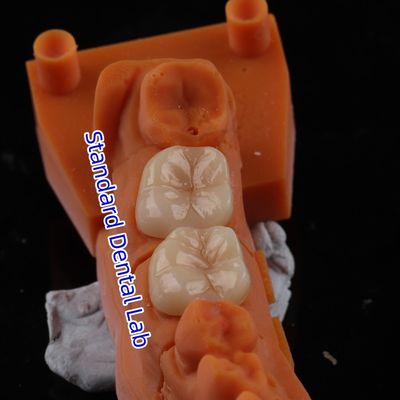 Купить Полный контур циркониевая корона прозрачность 3D PRO без фарфорового покрытия Стандартная стоматологическая лаборатория онлайн изготовление
