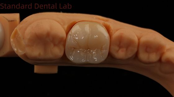 Купить Стоматологический цифровой полный цирконовый коронка с Noritake фарфоровой 3D-печать модели 5 лет гарантия онлайн изготовление
