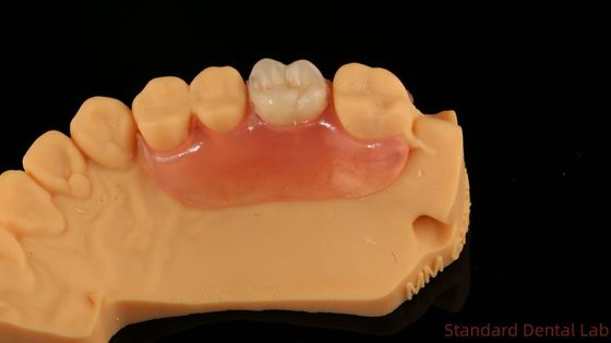 Купить Стоматологическая TCS Valplast Гибкие частичные зубные протезы Nesbit Valplast Finish Китайская стоматологическая лаборатория Valplast Clamp онлайн изготовление