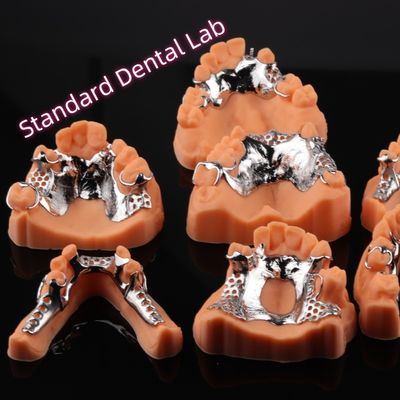 CAD CAM Металлическая рамка для съемного частичного протеза 3Shape Exocad