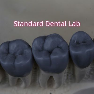 Профессиональная цифровая стоматологическая лаборатория Wax Up 3shape FDA одобрена