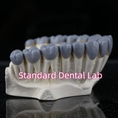 SDL стоматологическая лаборатория цифровой диагностики Wax Up Crown Bridge