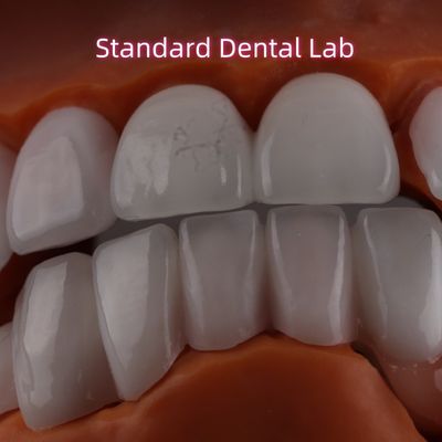 Литий Дициликатный слой Ivoclar Emax Zirconia Ламинированные фанеры Прозрачные OEM ODM