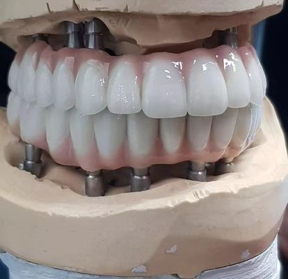 Строго изготовленный цирконий имплантант винтовой цемент, сохраненный для натуральных зубов