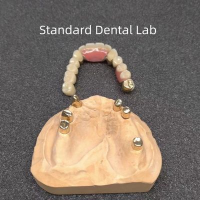 CAD CAM Зуб Частичный протез Присоединение Стоматологический специалист Точное