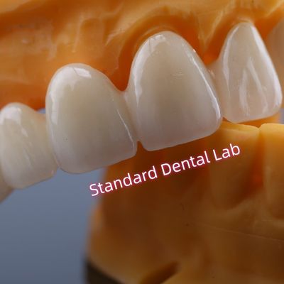 CAD CAM Mill Zirconia Crown Bridge Высоко биосовместимая