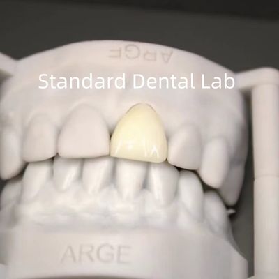 Цифровая CAD CAM стоматологическая лаборатория короны Прозрачные слоистые циркониевые короны