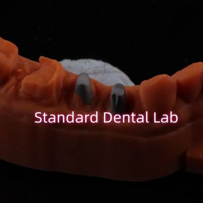 Металлическая корневая корона CAD CAM Порцелан / циркония