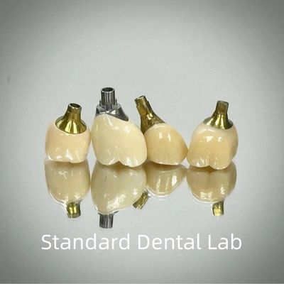 Профессиональный цирконий винтовой удерживаемый имплантат короны титана CAD CAM