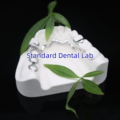 Частичная рамка Vitallium 2000 ISO CE и FDA Китайская стоматологическая лаборатория металлическая рамка