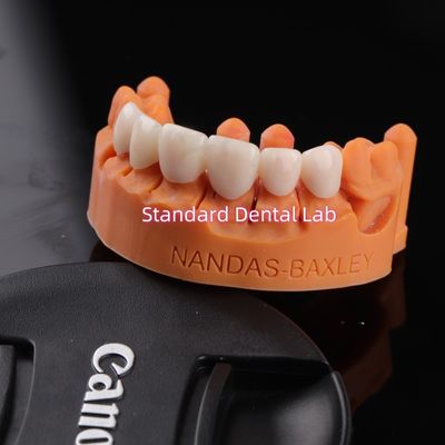 Удобство и функциональность с цифровой CAD CAM стоматологической лаборатории Прозрачный слойный цирконий мост