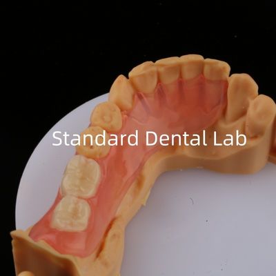 Ace Teeth Розовый/темный TCS Valplast Гибкие частичные зубные протезы для высокой эстетики