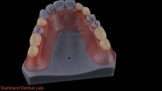 3D-печать высокой эстетики стоматологическая TCS Valplast гибкие частичные зубы стоматологическая лаборатория