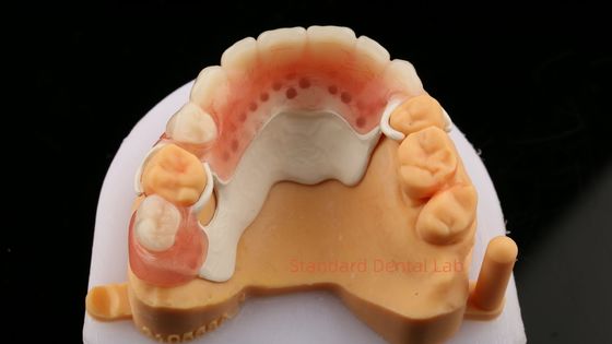 Peek Частичный дизайн рамы ISO CE и FDA Стоматологическая лаборатория акриловый частичный протез рамы