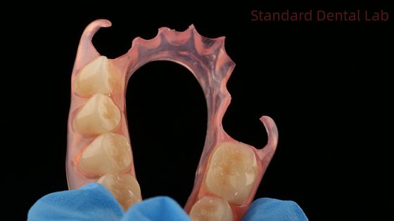 Стоматологическая TCS Valplast Гибкие частичные зубные протезы Стоматологическая лаборатория 3D-печать Модель высокая эстетика