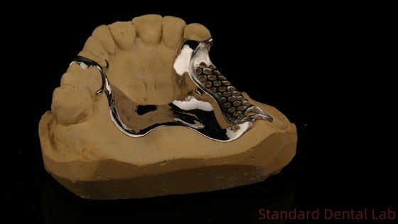 Высокопрочная 3D-печатная литая рама COCR Частичные зубные протезы Хром Кобальт Литая металлическая рама
