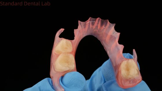 3D-печать зубной модели TCS Valplast Гибкие частичные зубные протезы Розовый / темный цвет