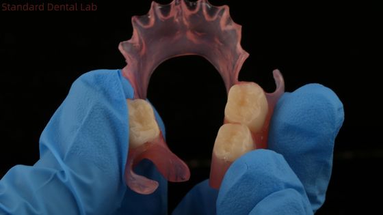 Стоматологическая TCS Valplast Гибкие частичные зубные протезы Nesbit Valplast Finish Китайская стоматологическая лаборатория Valplast Clamp