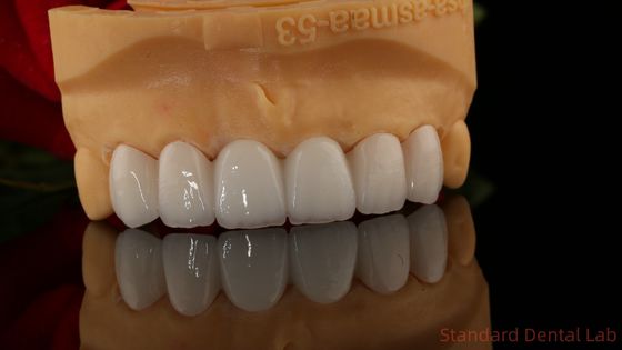 Полный контур циркониевая корона прозрачность 3D PRO без фарфорового покрытия Стандартная стоматологическая лаборатория