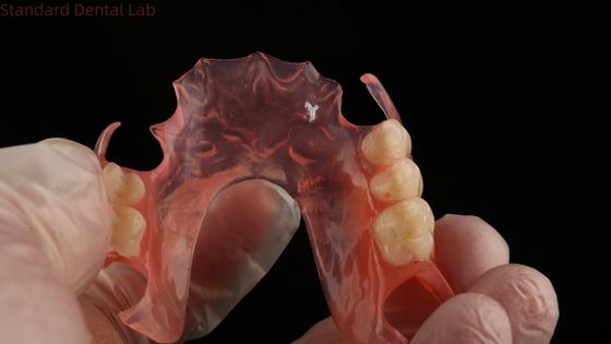 Ace Teeth Розовый/темный TCS Valplast Гибкие частичные зубные протезы для высокой эстетики