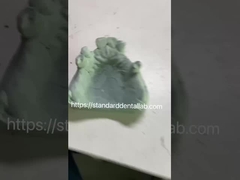 Быстрая и литая рама Ко-Кр Металлическая частичная зубная решетка для стоматологов