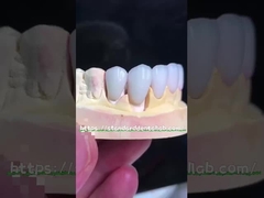 Естественный вид Emax Veneers Crown Biocompatibility Bleaching Shade с минимальной подготовкой