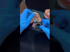 Прозрачная рама Акриловый металл Частичные зубные протезы Рамы Высокая эстетика Китайская стоматологическая лаборатория