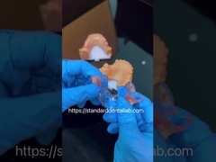 FDA Кобальт Хром Высокий Эстетический Прозрачный Рамка Частичная