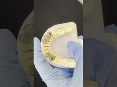 Металлический литой пост Корневой коронный кокр Точный ретентивный полный цирконий Bruxier