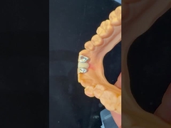 Зубные зубы PFM Maryland Bridge Высокая эстетика Сертификат FDA