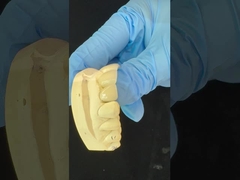 Полный контур циркониевой коронки/высокой эстетической натуральной настраиваемой циркониевой зубной мост