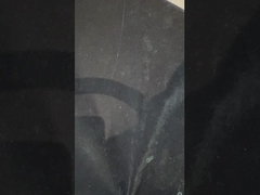 Титановые имплантаты поддерживают зубные протезы