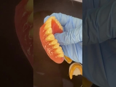 Полный верхний и нижний столешницы акриловые частичные зубы Ивокларные зубы Розовая резинка