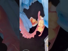 3D-печать высокой эстетики стоматологическая TCS Valplast гибкие частичные зубы стоматологическая лаборатория